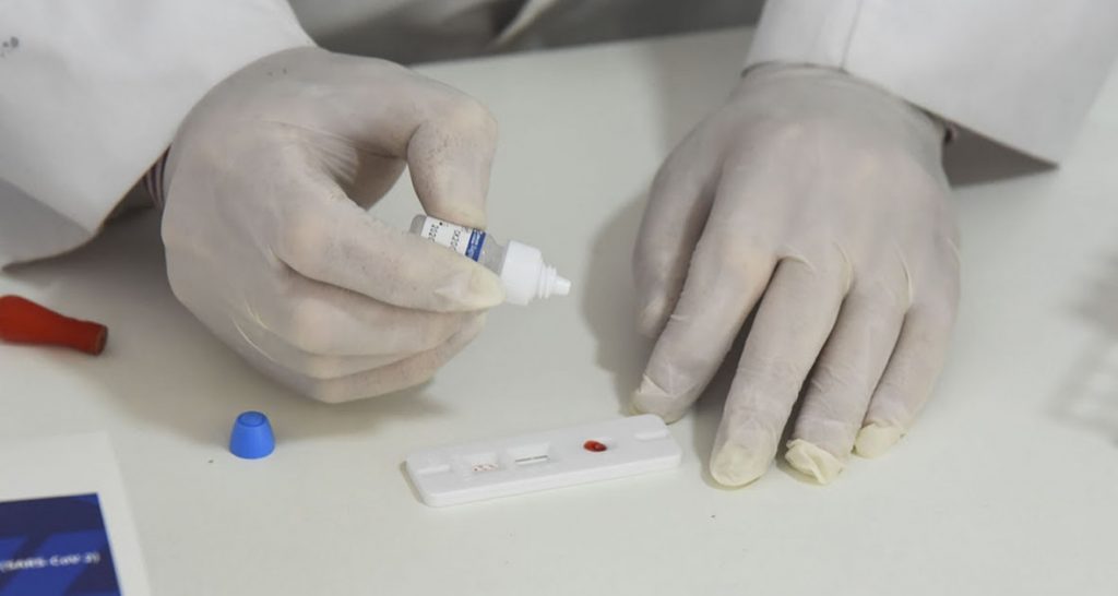 La provincia de Santa Fe adhirió al procedimiento y notificación del resultado de los autotest de Covid-19