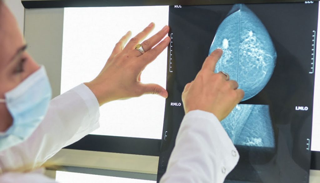 En el Cemafe aumentan los turnos para mamografías en el marco del mes de concienciación sobre el cáncer de mama