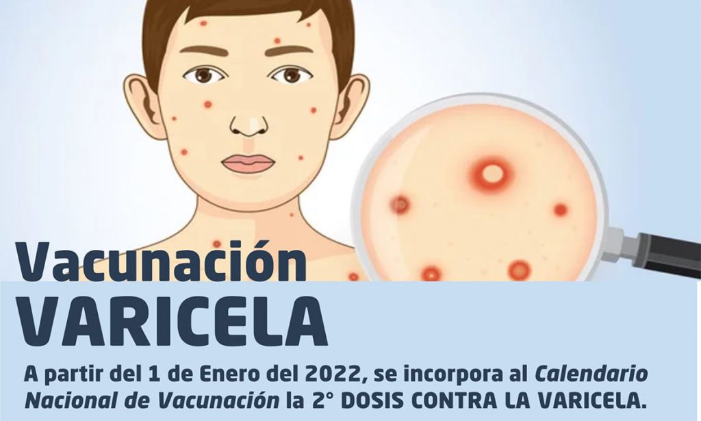 Se incorporó la segunda dosis contra la varicela al calendario nacional de vacunación